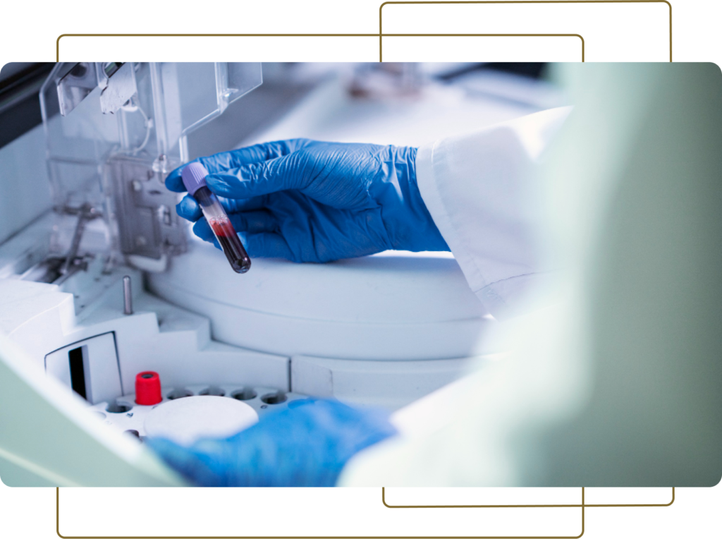 DSDSD-1024x764 HEMATOLOGIA PARA BANCO DE SANGUE