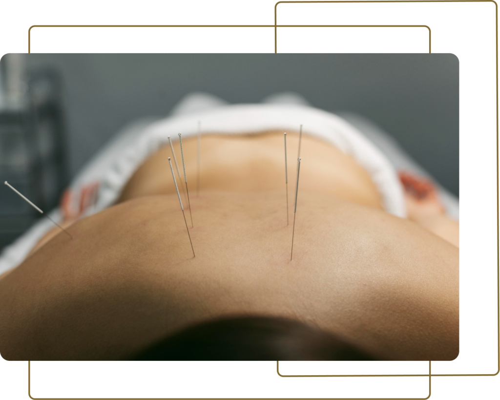 Group-132-1024x819 IMERSÃO PRÁTICA EM ACUPUNTURA