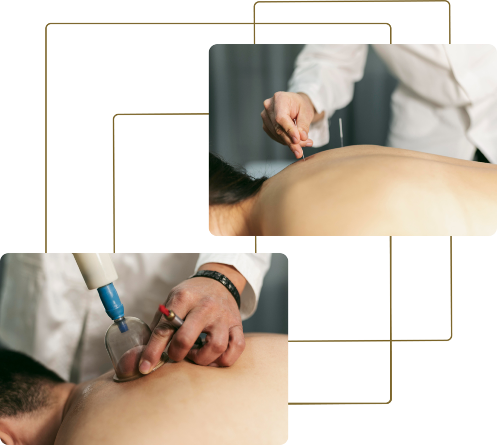 Group-133-1024x916 IMERSÃO PRÁTICA EM ACUPUNTURA