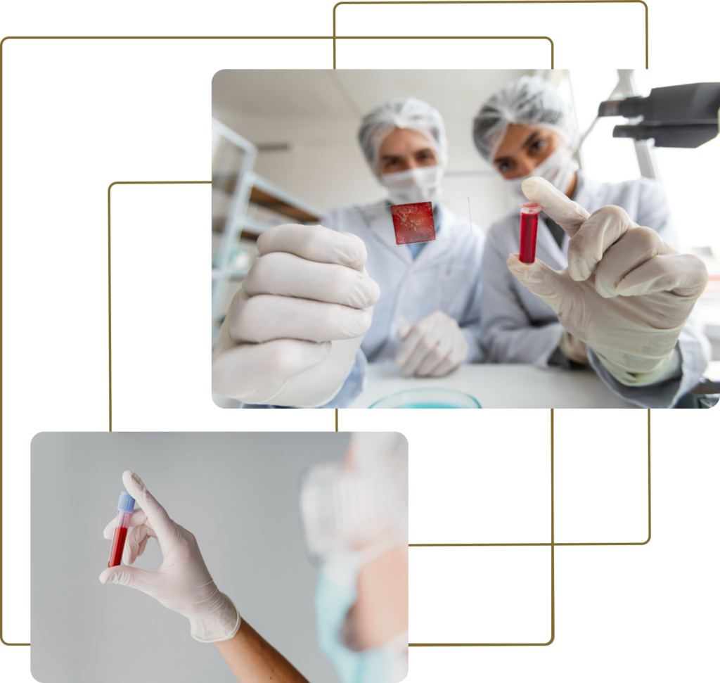 SSSS-1024x971 HEMATOLOGIA PARA BANCO DE SANGUE