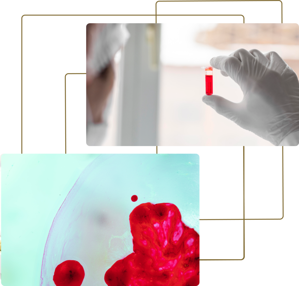 Group-23533-1024x979 HEMATOLOGIA CLÍNICA(MIELOGRAMA) E BANCO DE SANGUE